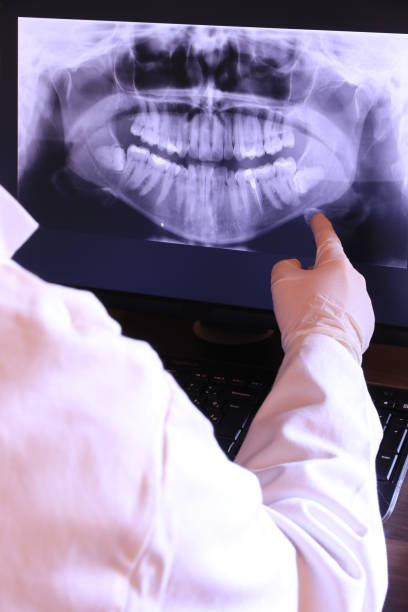 Best Emergency Denture Repair in Cedar Rapids, IA