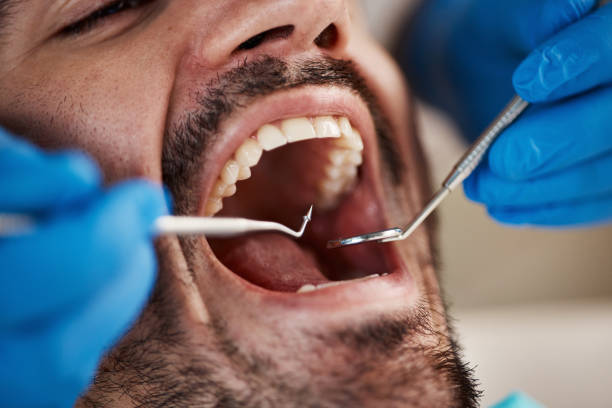 Best Emergency Treatment for Dental Infections or Abscesses in Cedar Rapids, IA