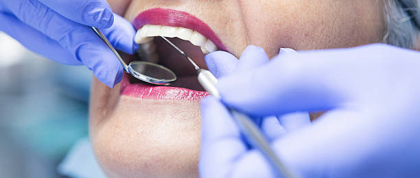 Best Emergency Denture Repair in Cedar Rapids, IA
